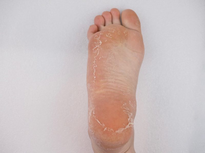 Holika Holika Baby Silky Foot One Shot Peeling kuorintasukat kokemuksia Ostolakossa Virve Vee